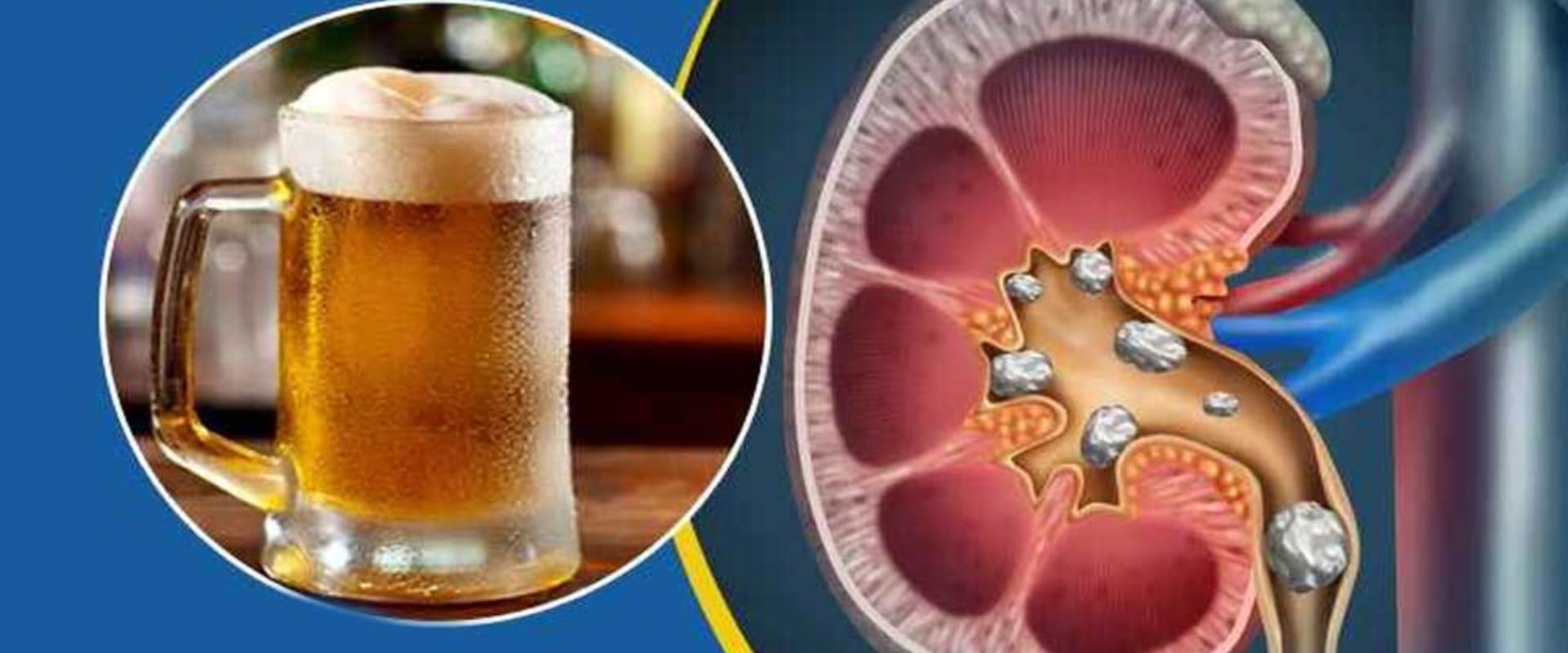 Is Beer Hard On Your Liver